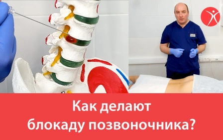 Как делают блокаду позвоночника?